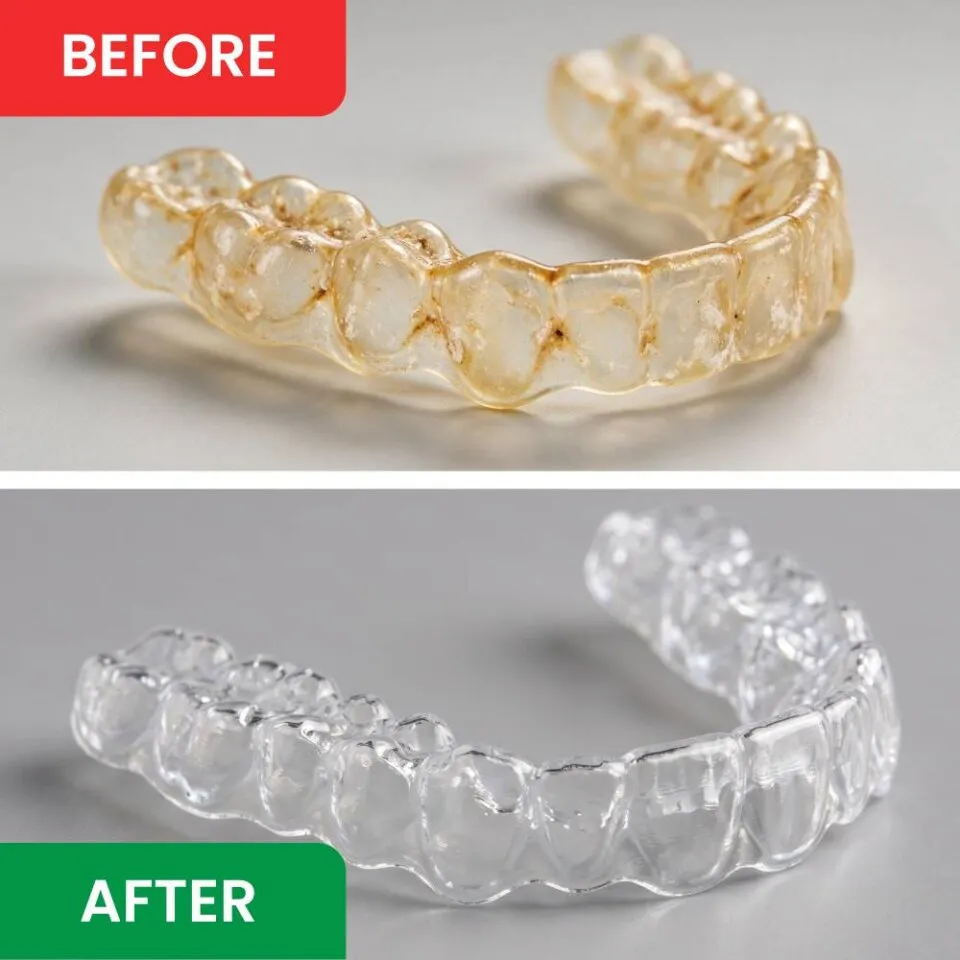 Before and after cleaning with DentaSonic